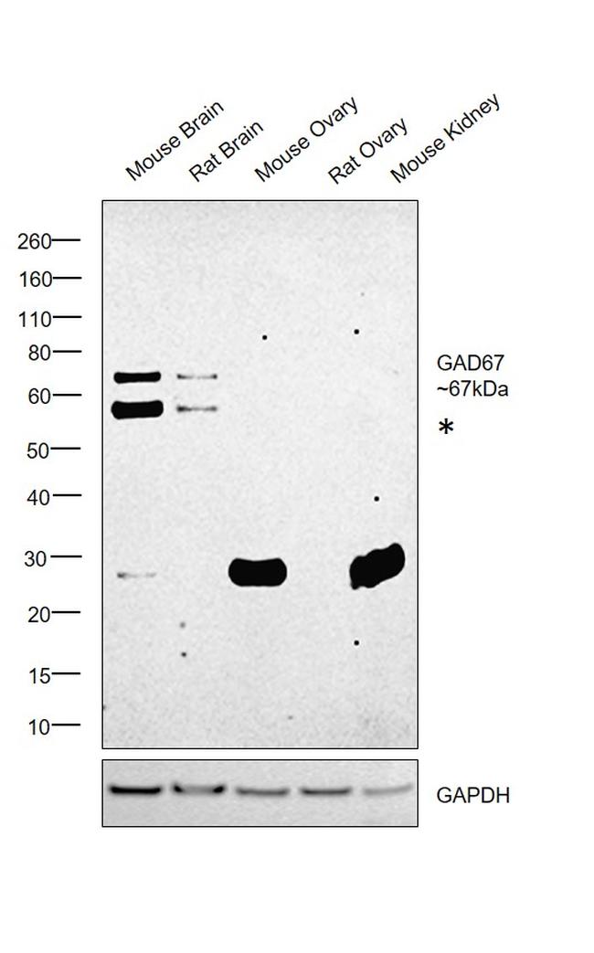 GAD67 Antibody in Western Blot (WB)