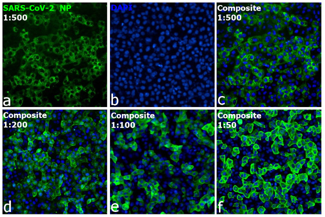 SARS/SARS-CoV-2 Nucleocapsid Monoclonal Antibody (05)