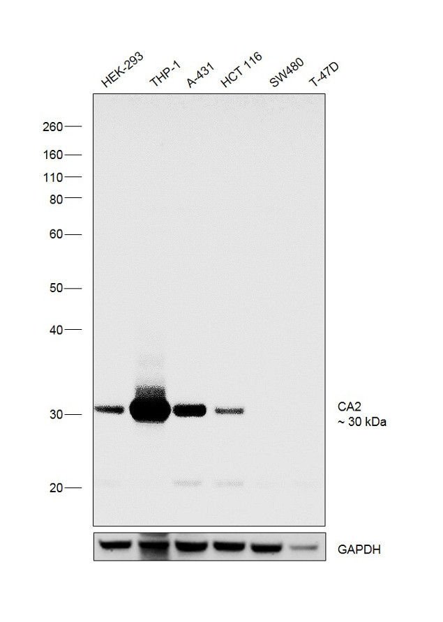 Carbonic Anhydrase II Antibody