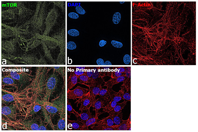 mTOR Antibody in Immunocytochemistry (ICC/IF)