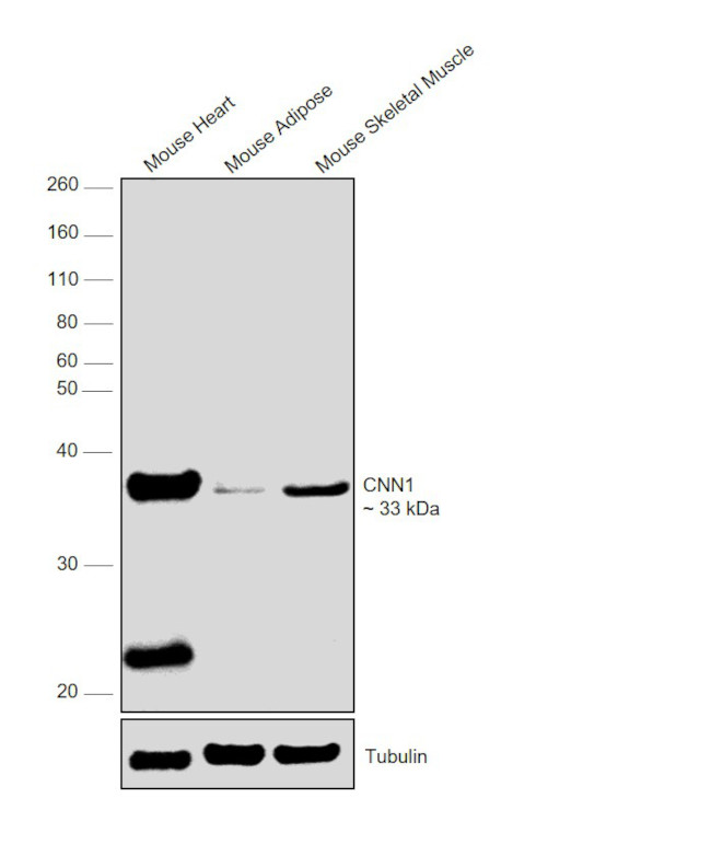 Calponin 1 Recombinant Rabbit Monoclonal Antibody (SI67-01)