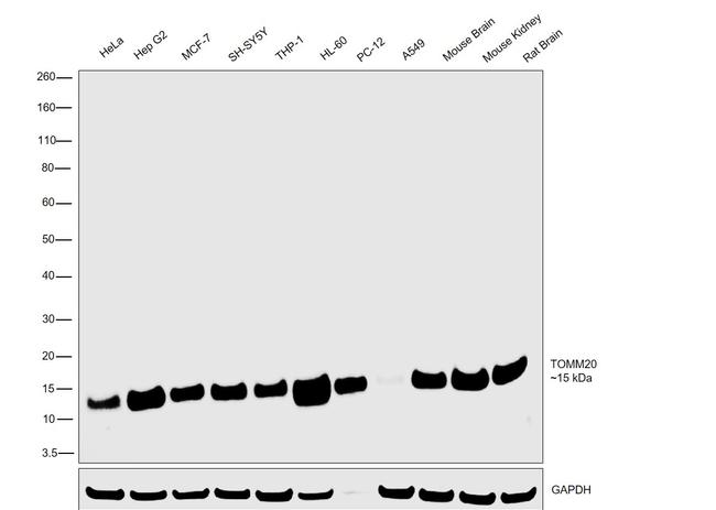 TOMM20 Recombinant Monoclonal Antibody (ST04-72) (MA5-32148)