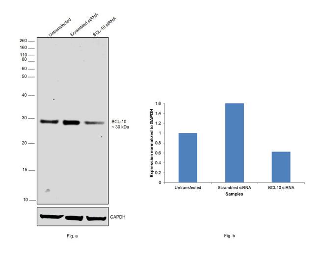 Bcl-10 Antibody in Western Blot (WB)