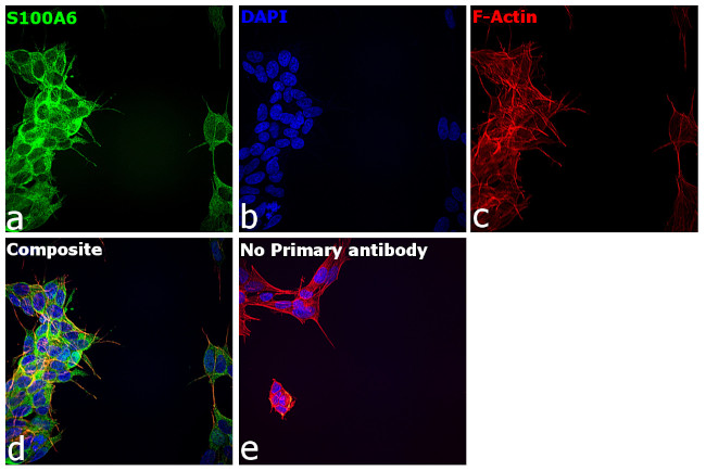 S100A6 Antibody in Immunocytochemistry (ICC/IF)