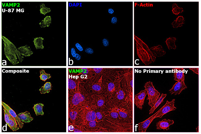 VAMP2 Antibody in Immunocytochemistry (ICC/IF)