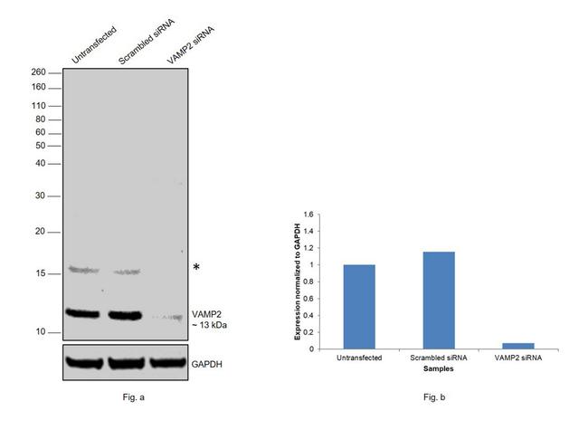 VAMP2 Antibody in Western Blot (WB)