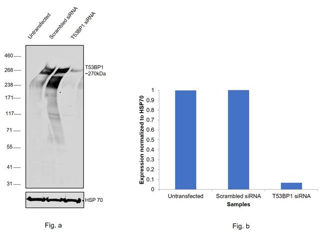 53BP1 Antibody in Western Blot (WB)