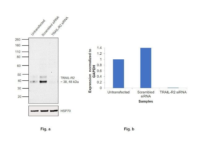 TRAIL-R2 (DR5) Antibody