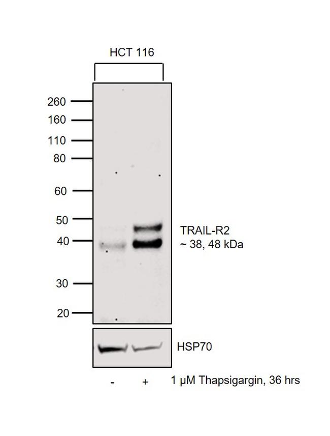 TRAIL-R2 (DR5) Antibody