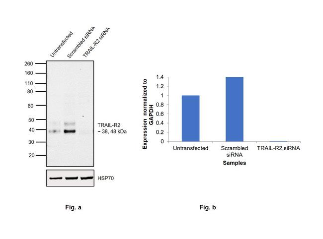 TRAIL-R2 (DR5) Antibody in Western Blot (WB)