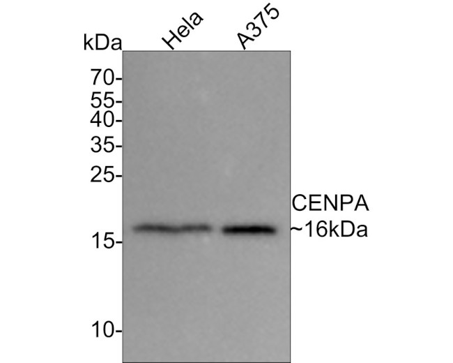 CENPA Antibody in Western Blot (WB)