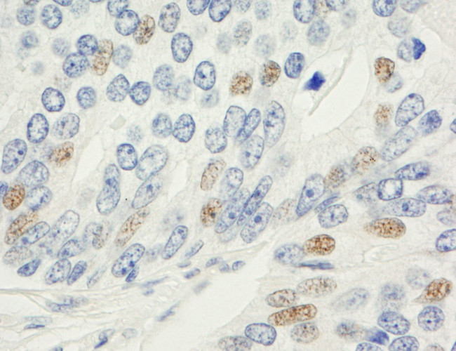 MAD1 Antibody in Immunohistochemistry (IHC)