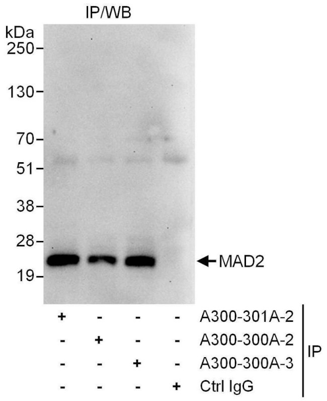 MAD2 Antibody in Immunoprecipitation (IP)