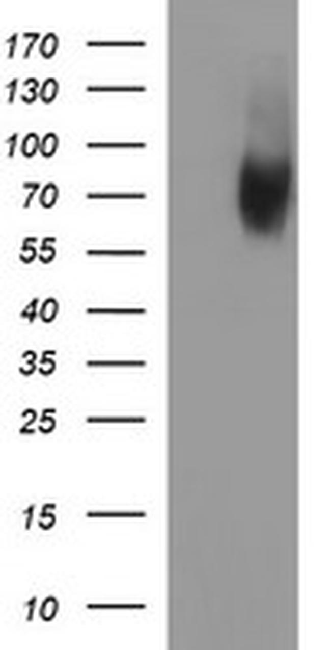 MADCAM1 Antibody in Western Blot (WB)