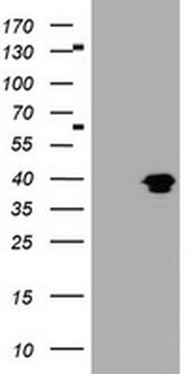 MAGEB1 Antibody in Western Blot (WB)