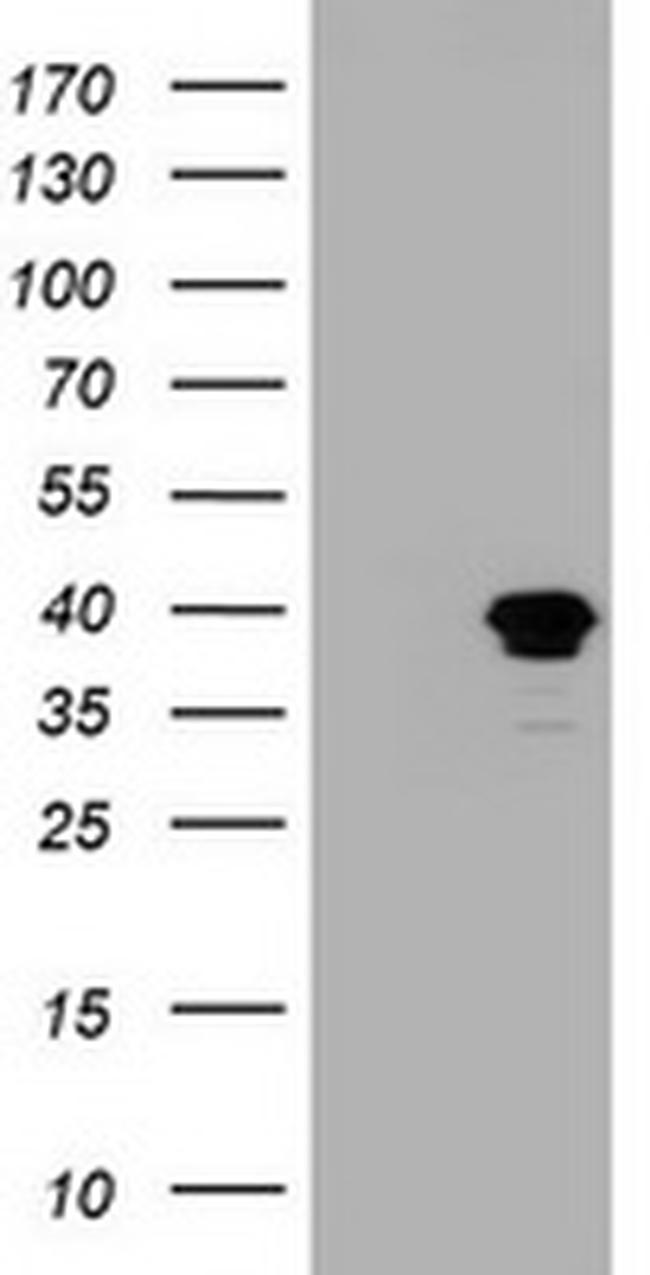 MAGEB1 Antibody in Western Blot (WB)