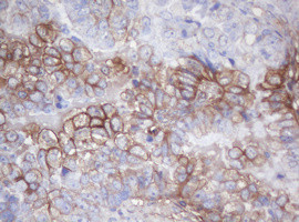 MAGEB18 Antibody in Immunohistochemistry (Paraffin) (IHC (P))