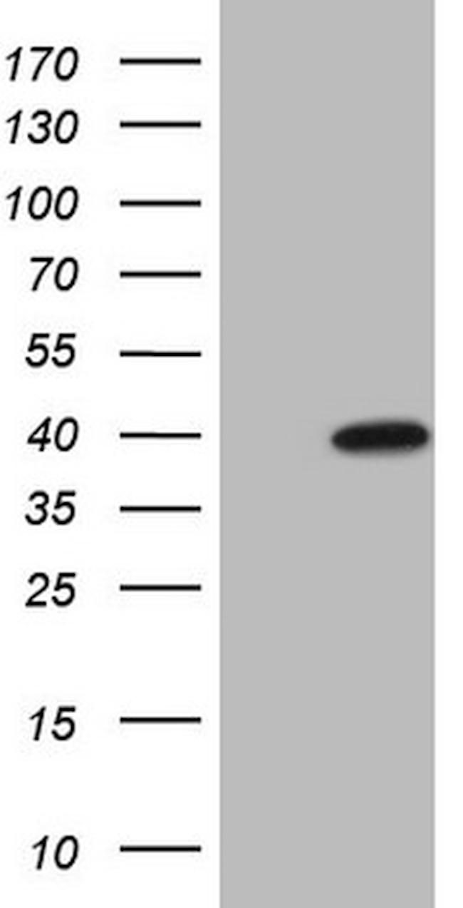 MAGEB3 Antibody in Western Blot (WB)