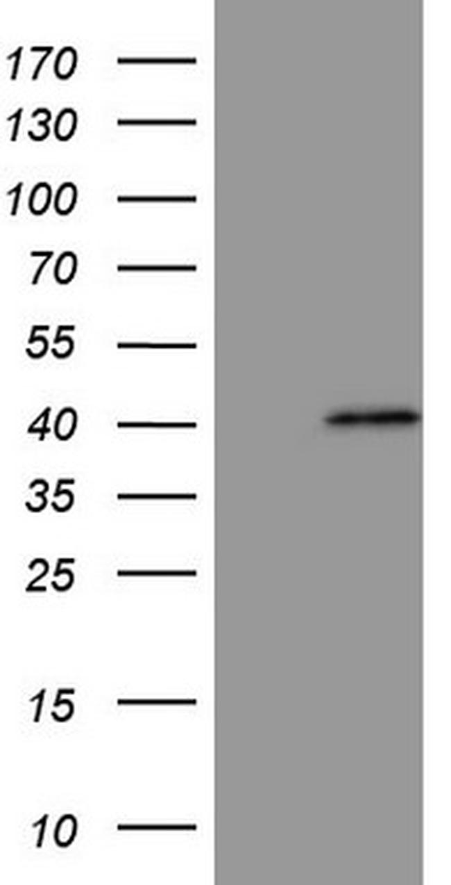 MAGEB3 Antibody in Western Blot (WB)