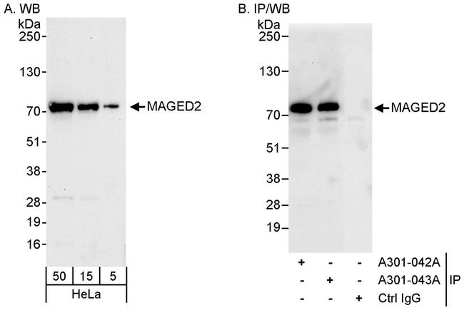 MAGED2 Antibody in Western Blot (WB)