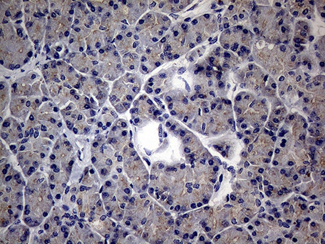 MAK Antibody in Immunohistochemistry (Paraffin) (IHC (P))