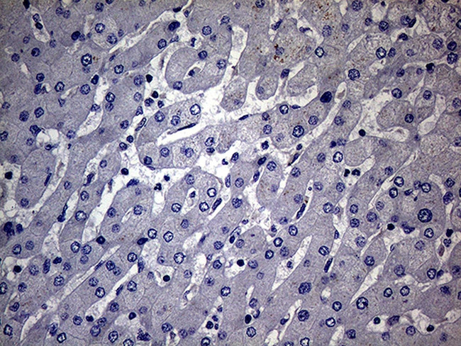 MAK Antibody in Immunohistochemistry (Paraffin) (IHC (P))