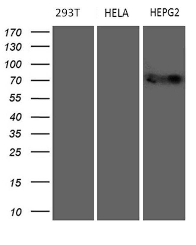 MAK Antibody in Western Blot (WB)