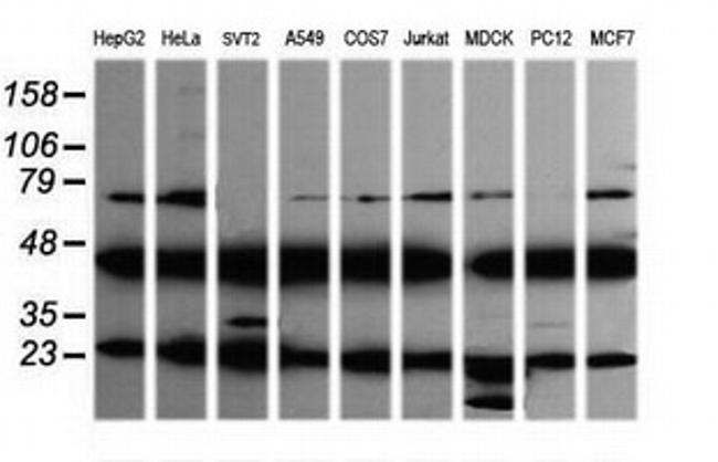 MAP2K1 Antibody in Western Blot (WB)