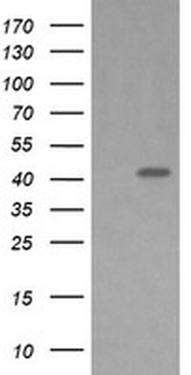 MAP2K1 Antibody in Western Blot (WB)