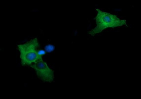 MAP2K2 Antibody in Immunocytochemistry (ICC/IF)