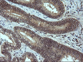 MAP2K3 Antibody in Immunohistochemistry (Paraffin) (IHC (P))