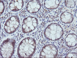 MAP2K3 Antibody in Immunohistochemistry (Paraffin) (IHC (P))