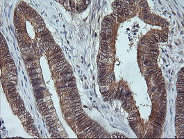 MAP2K3 Antibody in Immunohistochemistry (Paraffin) (IHC (P))