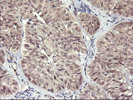 MAP2K3 Antibody in Immunohistochemistry (Paraffin) (IHC (P))