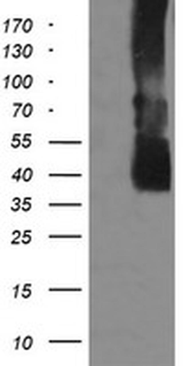 MAP2K3 Antibody in Western Blot (WB)