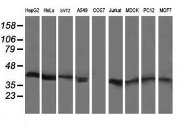 MAP2K3 Antibody in Western Blot (WB)