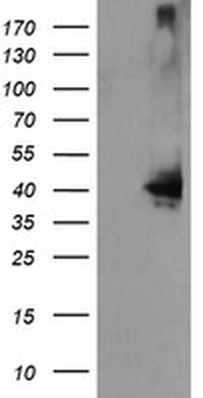 MAP2K3 Antibody in Western Blot (WB)