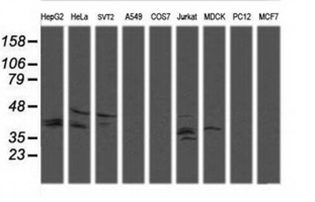 MAP2K3 Antibody in Western Blot (WB)