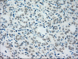 MAP2K4 Antibody in Immunohistochemistry (Paraffin) (IHC (P))