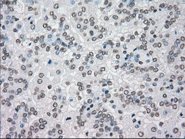 MAP2K4 Antibody in Immunohistochemistry (Paraffin) (IHC (P))