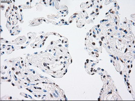 MAP2K4 Antibody in Immunohistochemistry (Paraffin) (IHC (P))