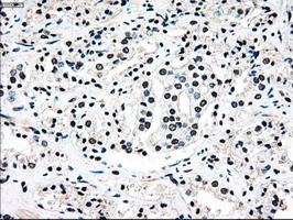 MAP2K4 Antibody in Immunohistochemistry (Paraffin) (IHC (P))