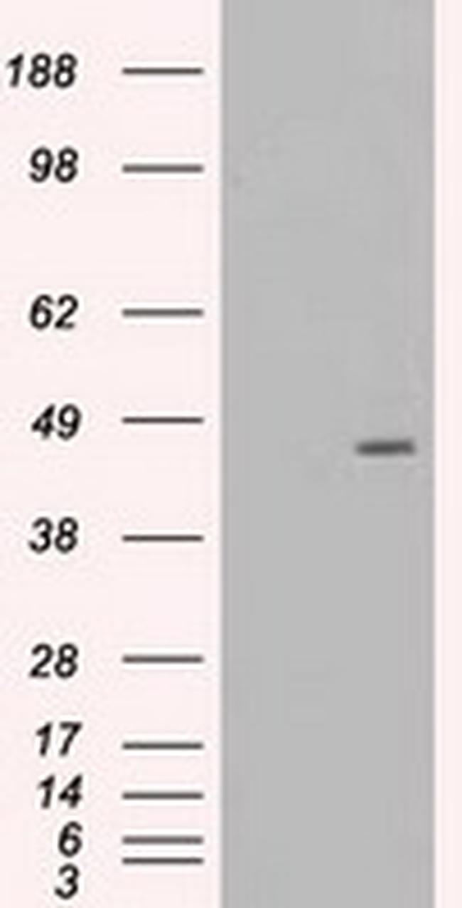 MAP2K4 Antibody in Western Blot (WB)