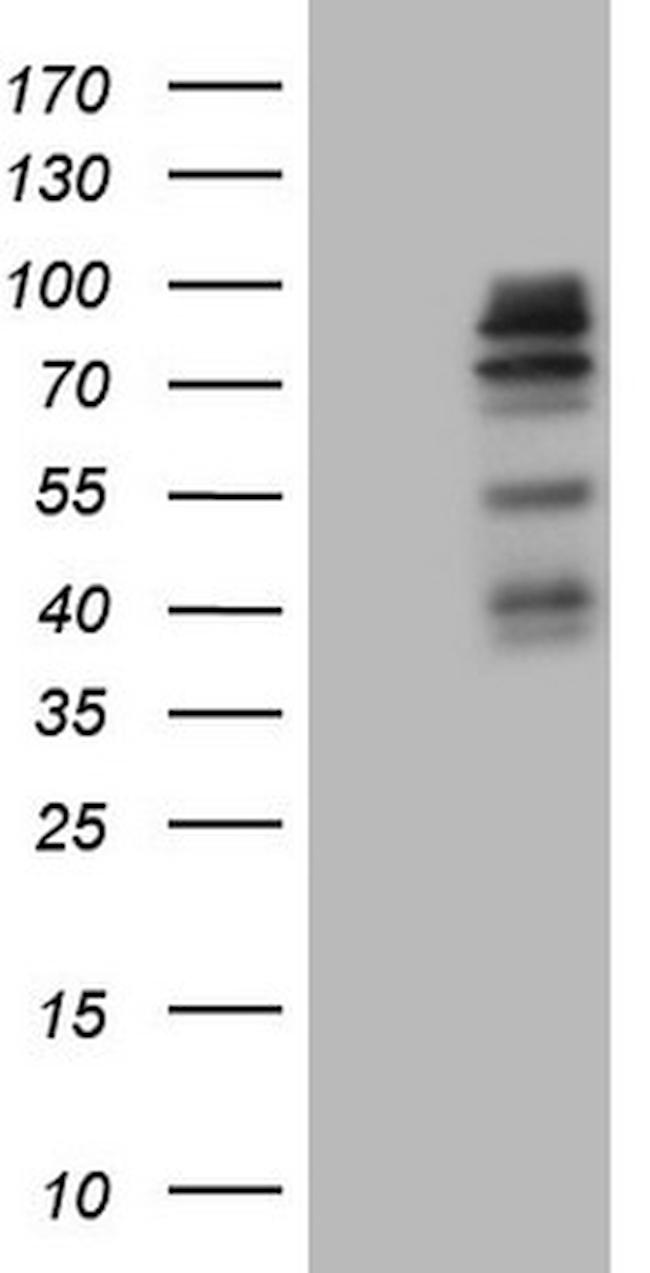 MAP3K15 Antibody in Western Blot (WB)