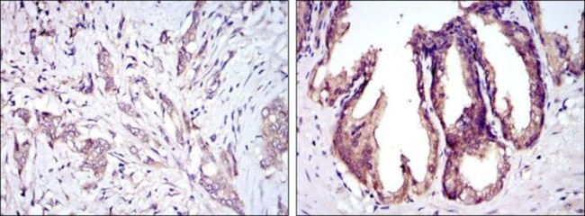 ASK1 Antibody in Immunohistochemistry (Paraffin) (IHC (P))