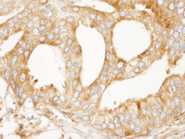 MAP4 Antibody in Immunohistochemistry (IHC)