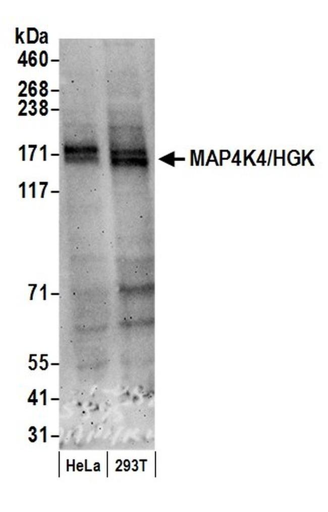 MAP4K4/HGK Antibody in Western Blot (WB)