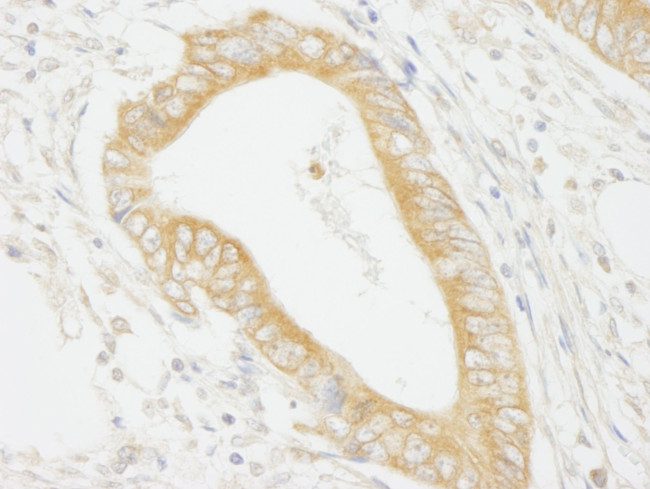 MAP4K4/HGK Antibody in Immunohistochemistry (IHC)