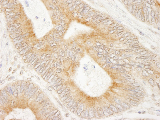 MAP7 Antibody in Immunohistochemistry (IHC)