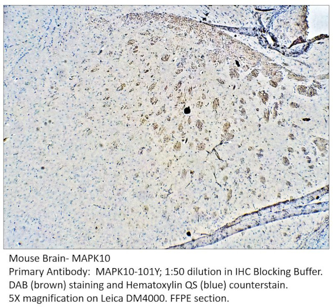MAPK10 Antibody in Immunohistochemistry (IHC)